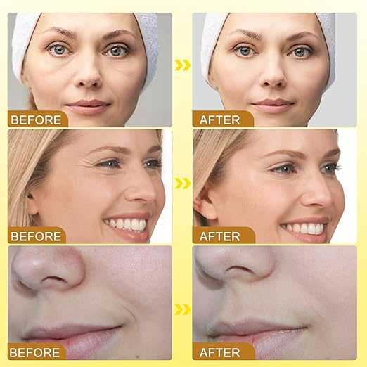 Before and after comparison of facial features with a yellow background