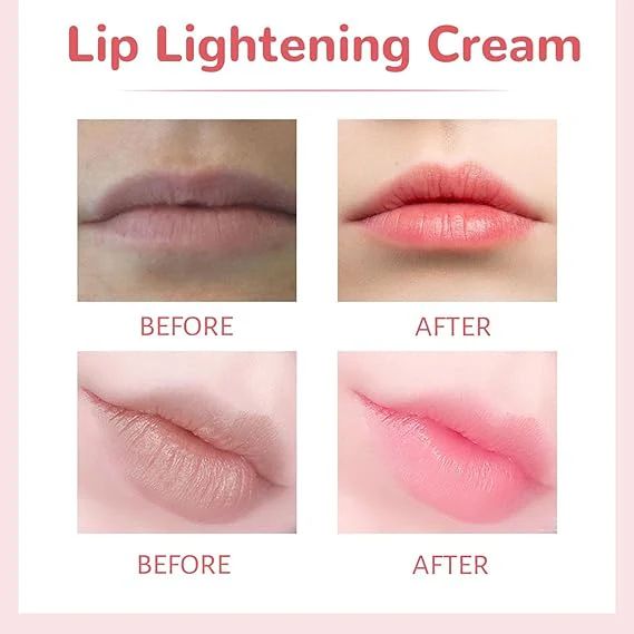 EELHOE Lips Bleaching Cream Balm
