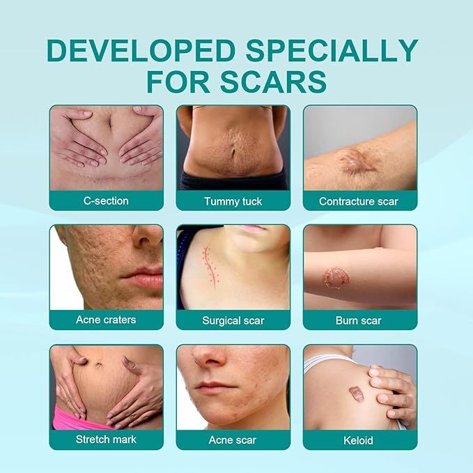 Scars on various parts of the body with text 'Developed Specially For Scars' on a light blue background.