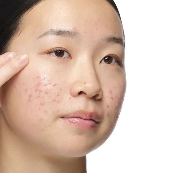 The Ordinary Aloe 2% + Nag 2% Solution 30ml