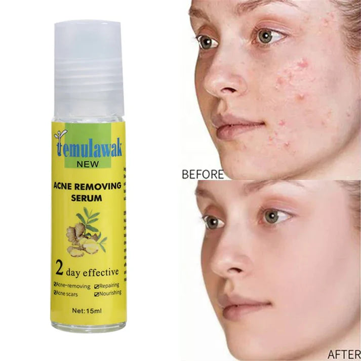 Temulawak New Acne Removing Serum