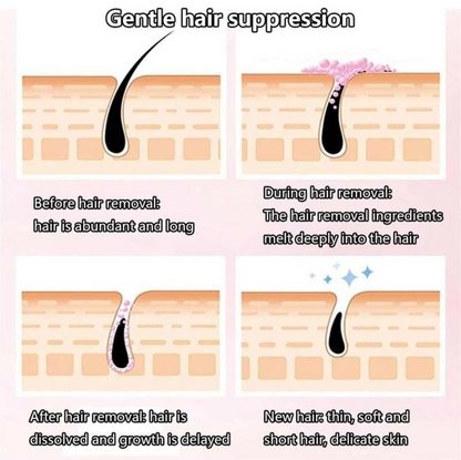 Kingyes A four-panel infographic titled 'Gentle hair suppression' showing illustrated skin layers and hair follicles with explanatory text about before, during, after, and the effect of hair removal ingredients.