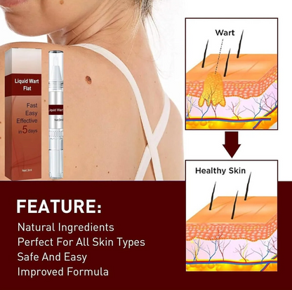 Liquid wart flat treatment shown with a model's shoulder and neck, product box and pen applicator, and skin diagram illustrations showing wart removal and healthy skin.