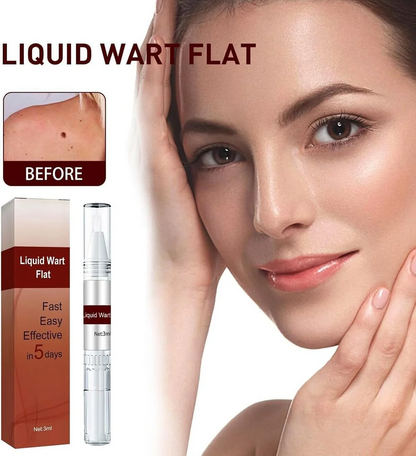 A beauty ad showing a woman touching her face beside a small before/after inset of a skin mole, with large text reading 'LIQUID WART FLAT' and product packaging and a clear tube of the product shown.