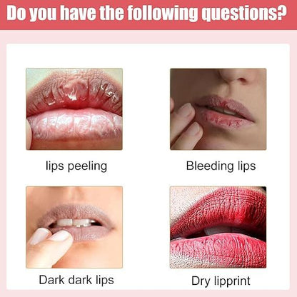 EELHOE Lips Bleaching Cream Balm