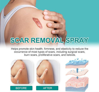 South Moon Medical Scar Removal Spray