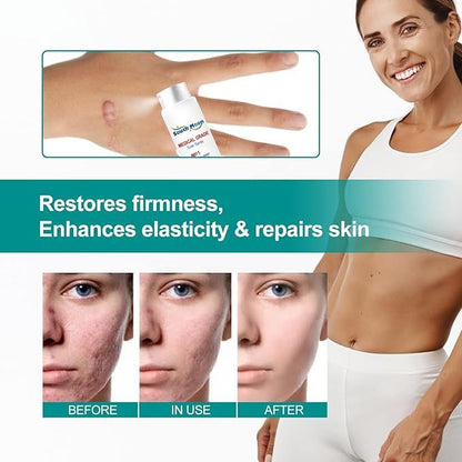 South Moon Medical Scar Removal Spray