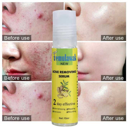 Temulawak New Acne Removing Serum