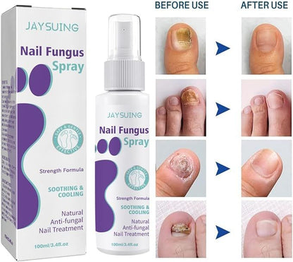 JAYSUING Nail Fungus Spray