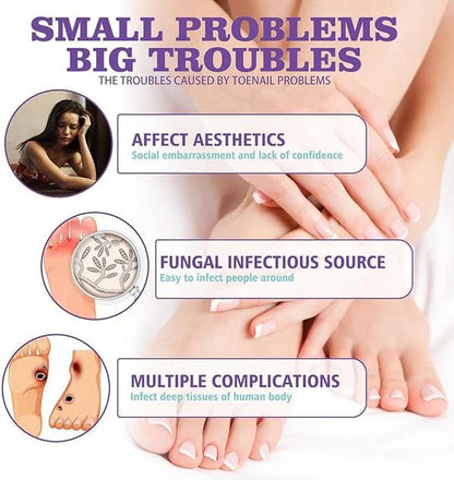 JAYSUING Nail Fungus Spray