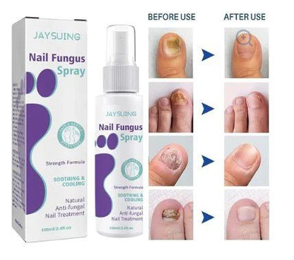 JAYSUING Nail Fungus Spray