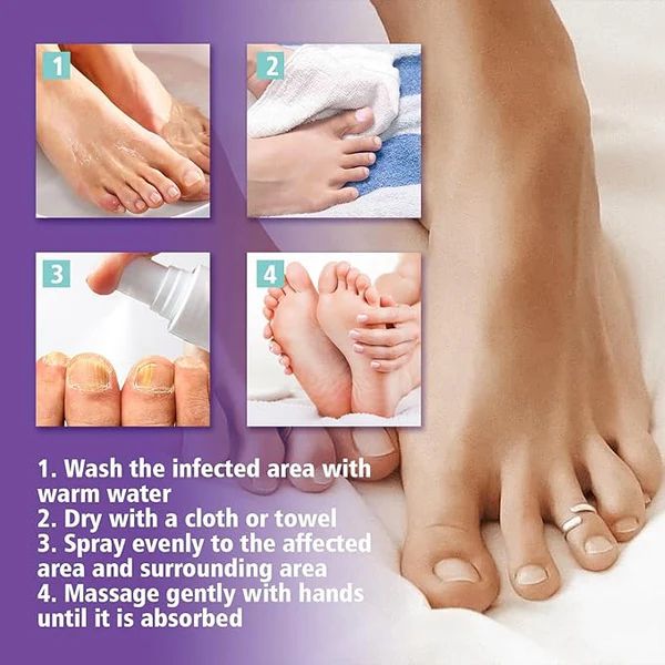 JAYSUING Nail Fungus Spray
