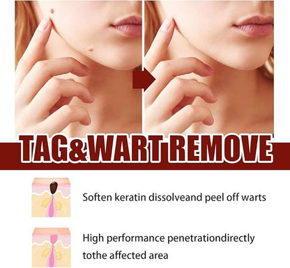 Tags and moles remover